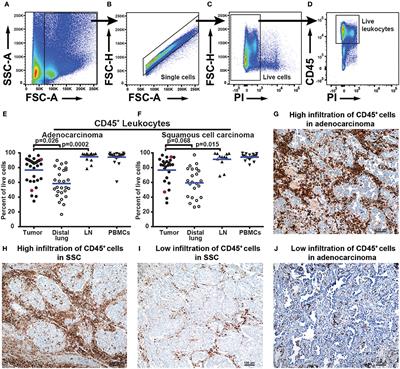 Immune Cell Composition in Human Non-small Cell Lung Cancer